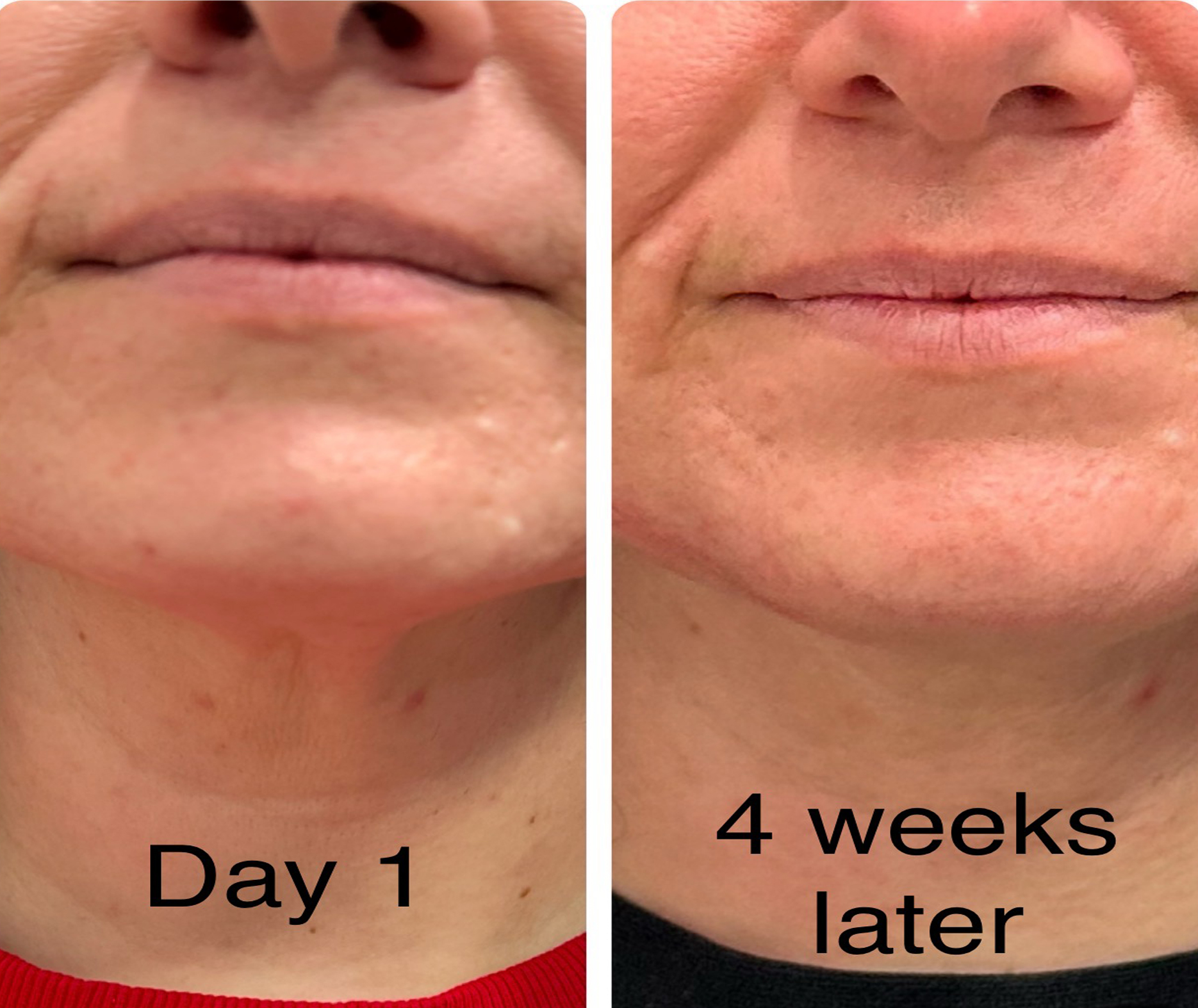 Before treatment placeholder
